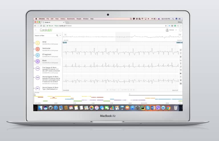 View of an EKG reading via Cardio.AI.